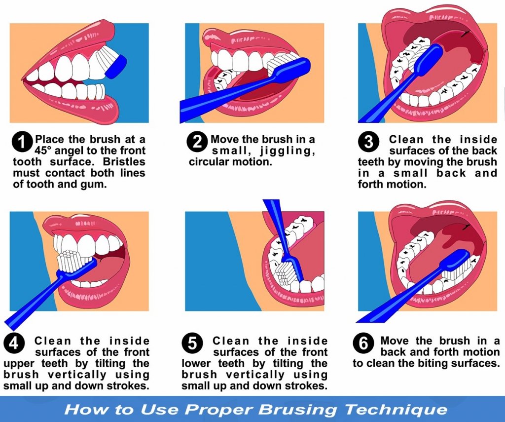 Proper Toothbrushing Technique Diagram